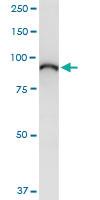 Anti-ELAC2 Polyclonal Antibody Pair