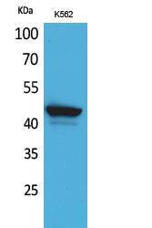 Anti-CD1E antibody