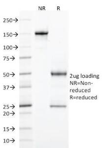 SDS-PAGE analysis of Anti-StAR Antibody [STAR/2077] under non-reduced and reduced conditions; showing intact IgG and intact heavy and light chains, respectively SDS-PAGE analysis confirms the integrity and purity of the antibody