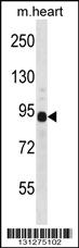 Anti-DTNA Rabbit Polyclonal Antibody