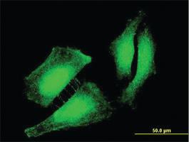 Anti-FOXO3 Mouse Monoclonal Antibody [clone: 3F12]