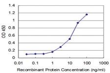 Anti-SUPT5H Mouse Monoclonal Antibody [clone: 1G3]