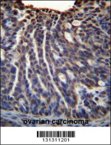 Anti-HOXB3 Rabbit Polyclonal Antibody