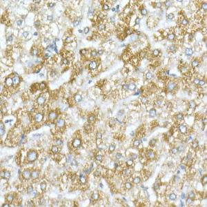 Immunohistochemistry analysis of paraffin-embedded human liver using Anti-VDAC1/Porin Antibody (A12700) at a dilution of 1:20 (40X lens). Perform high pressure antigen retrieval with 10 mM citrate buffer pH 6.0 before commencing with IHC staining protocol