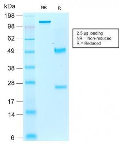 SDS-PAGE analysis of Anti-Iba1 Antibody [rAIF1/1909] under non-reduced and reduced conditions; showing intact IgG and intact heavy and light chains, respectively. SDS-PAGE analysis confirms the integrity and purity of the antibody