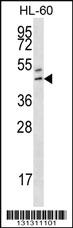 Anti-HOXB3 Rabbit Polyclonal Antibody