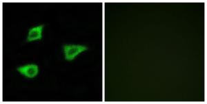 Immunofluorescence analysis of LOVO cells using Anti-CHRM4 Antibody The right hand panel represents a negative control, where the antibody was pre-incubated with the immunising peptide