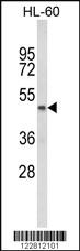 Anti-OTUB2 Rabbit Polyclonal Antibody