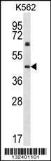 Anti-KRT12 Rabbit Polyclonal Antibody (AP (Alkaline Phosphatase))