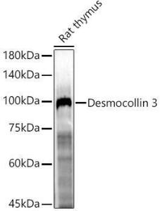 Western blot analysis of Rat thymus, using Anti-Desmocollin 3 Antibody (A305725) at 1:500 dilution