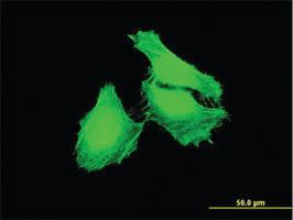 Anti-FBXL22 Mouse Monoclonal Antibody [clone: 1B6]