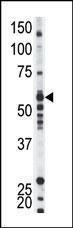 Anti-YES1 Rabbit Polyclonal Antibody