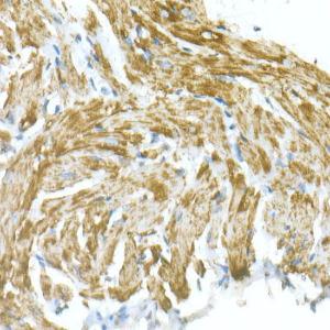 Immunohistochemistry analysis of paraffin-embedded mouse heart using Anti-VDAC1/Porin Antibody (A12700) at a dilution of 1:20 (40X lens). Perform high pressure antigen retrieval with 10 mM citrate buffer pH 6.0 before commencing with IHC staining protocol