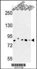 Anti-CHPF Rabbit Polyclonal Antibody (APC (Allophycocyanin))