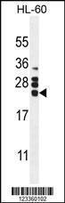 Anti-CSF2 Rabbit Polyclonal Antibody