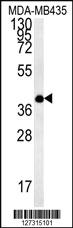 Anti-EMC3 Rabbit Polyclonal Antibody