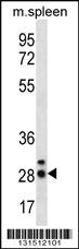 Anti-CIB4 Rabbit Polyclonal Antibody