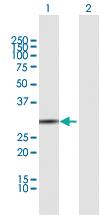 Anti-BPNT1 Mouse Polyclonal Antibody