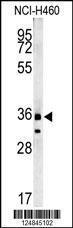 Anti-FA49A Rabbit Polyclonal Antibody (Biotin)