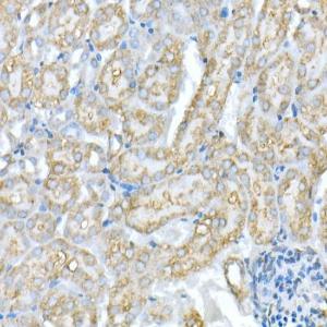 Immunohistochemistry analysis of paraffin-embedded rat liver using Anti-VDAC1/Porin Antibody (A12700) at a dilution of 1:20 (40X lens). Perform high pressure antigen retrieval with 10 mM citrate buffer pH 6.0 before commencing with IHC staining protocol