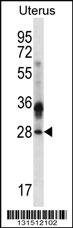 Anti-CIB4 Rabbit Polyclonal Antibody