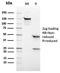 SDS-PAGE analysis of Anti-ALK Antibody [rALK1/1504] under non-reduced and reduced conditions; showing intact IgG and intact heavy and light chains, respectively. SDS-PAGE analysis confirms the integrity and purity of the antibody