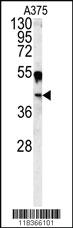 Anti-MMP11 Rabbit Polyclonal Antibody