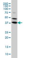 Anti-BPNT1 Mouse Monoclonal Antibody [clone: 2E1]