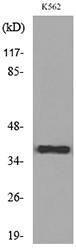 Anti-CD1C antibody