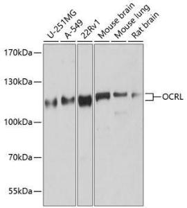 Western blot analysis of extracts of various cell lines, using Anti-OCRL Antibody (A307263) at 1:1,000 dilution The secondary antibody was Goat Anti-Rabbit IgG H&L Antibody (HRP) at 1:10,000 dilution Lysates/proteins were present at 25 µg per lane