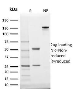 SDS-PAGE analysis of Anti-StAR Antibody [STAR/2140] under non-reduced and reduced conditions; showing intact IgG and intact heavy and light chains, respectively. SDS-PAGE analysis confirms the integrity and purity of the Antibody