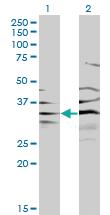 Anti-BPNT1 Mouse Monoclonal Antibody [clone: 2E1]