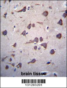 Anti-FKTN Rabbit Polyclonal Antibody (Biotin)