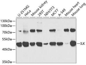 Western blot analysis of extracts of various cell lines, using Anti-Integrin linked ILK Antibody (A12709) at 1:1,000 dilution