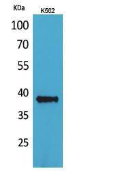 Anti-CD1C antibody