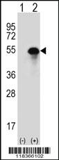 Anti-CA14 Rabbit Polyclonal Antibody