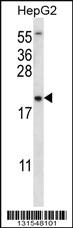 Anti-UBE2NL Rabbit Polyclonal Antibody