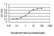 Anti-UBE2C Mouse Monoclonal Antibody [clone: 9D3]