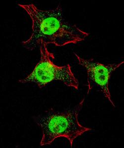 Anti-ITGA6, Isoform 2 Rabbit Polyclonal Antibody (AP (Alkaline Phosphatase))