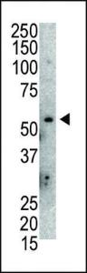 Anti-MDM2 Rabbit Polyclonal Antibody (AP (Alkaline Phosphatase))