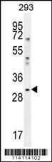 Anti-YBX1 Rabbit Polyclonal Antibody