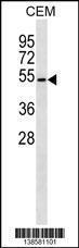 Anti-B4GALT4 Rabbit Polyclonal Antibody (FITC (Fluorescein Isothiocyanate))