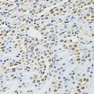 Immunohistochemistry analysis of paraffin-embedded rat kidney using Anti-Integrin linked ILK Antibody (A12709) at a dilution of 1:200 (40X lens)