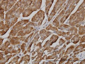 Anti-BPNT1 Mouse Monoclonal Antibody [clone: 2E1]