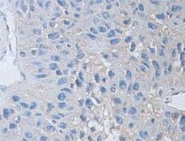 Anti-CASP1 Rabbit Polyclonal Antibody