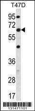 Anti-FA83D Rabbit Polyclonal Antibody (AP (Alkaline Phosphatase))