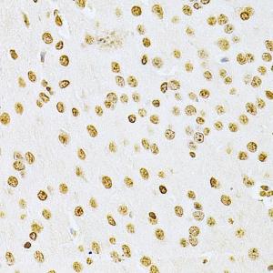 Immunohistochemistry analysis of paraffin-embedded mouse brain using Anti-Integrin linked ILK Antibody (A12709) at a dilution of 1:200 (40X lens)