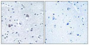 Anti-BMP8a Rabbit Polyclonal Antibody