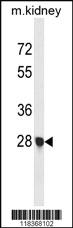 Anti-FCGR2C Rabbit Polyclonal Antibody