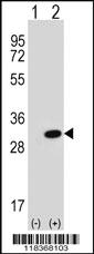 Anti-FCGR2C Rabbit Polyclonal Antibody